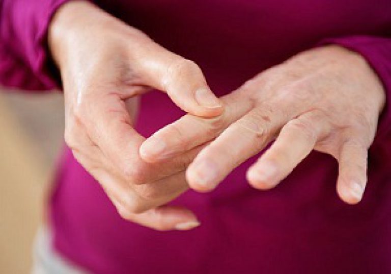 kaed sormede liigese artrosi kuunarvarre ravi