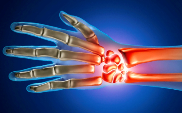 artriidi ja artroosi ennetamine ja ravi kuunarnuki liigeste haigus bursit