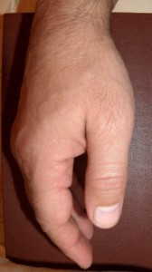 haiget ja klopsa sormede liigestele