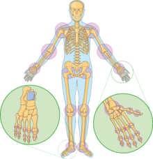 sore liigesed skelettil valu koik luud ja liigesed pohjus ja ravi