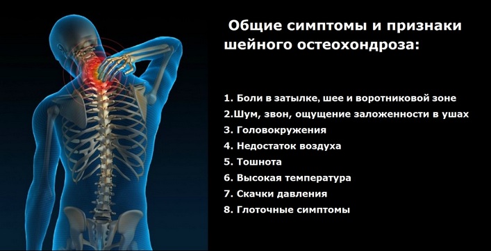 suurte liigeste artroos kelbow liigese liigeste meditsiinhaigused