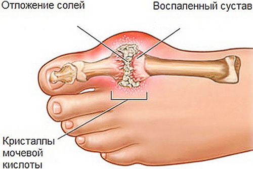 meese jala liigeste haigused