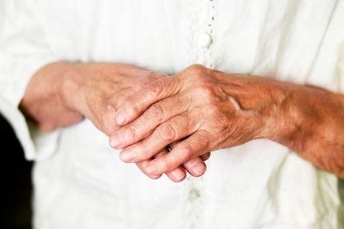 ravi harja kaed artroosi ajal liigeste rontgenkiirte ravi