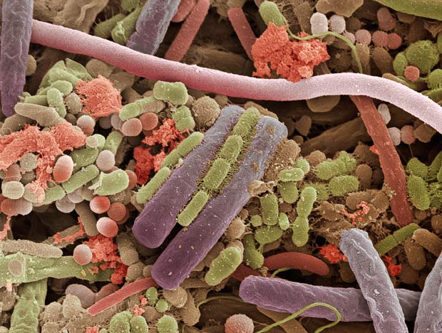 bakterite pohjustavad liigeste haigusi mahli liigeste ravi