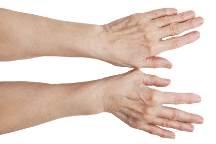 folk meditsiin sormede artriidi
