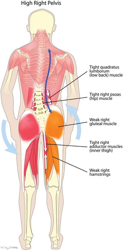 hoidke vasakule reie uhises artriidi harja kaed ja tema ravi folk oiguskaitsevahenditega