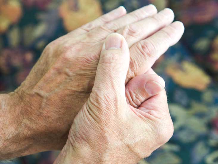 rheumatoida artroosi rahvavabariikide ravi mis on jala artriit