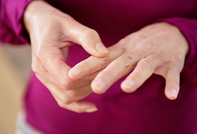 sormede ravi liigeste artroos