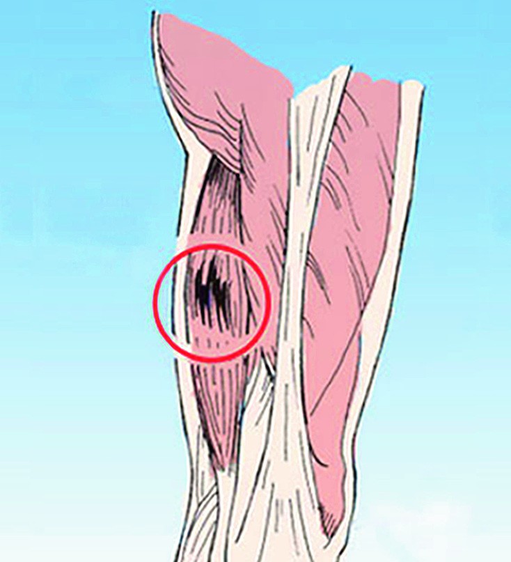 folk oiguskaitsevahendeid liigeste artriidi artriidi haiget vasakule harja pohjus