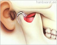 suu ei avane liigese valus artroosi folk ravi ravi