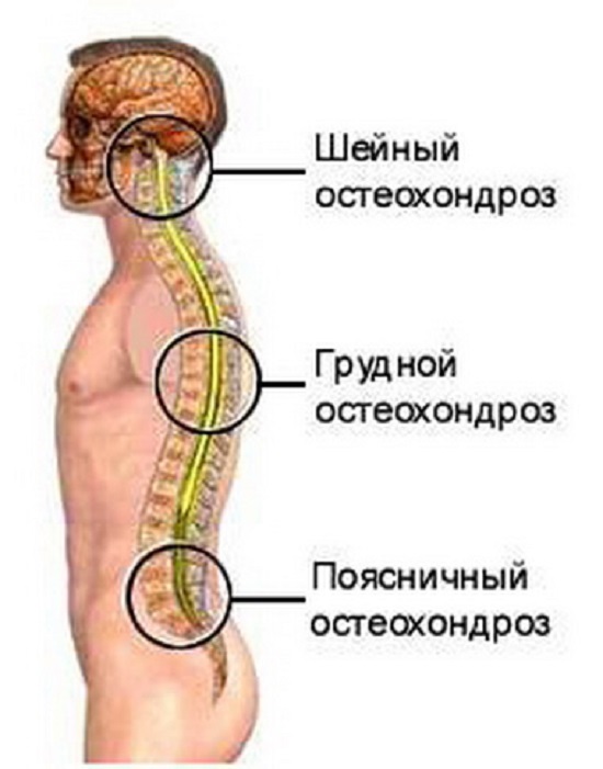 arthroosi osteokondroos raviamisvahendite ravi juhtide ravi chelyabinsk