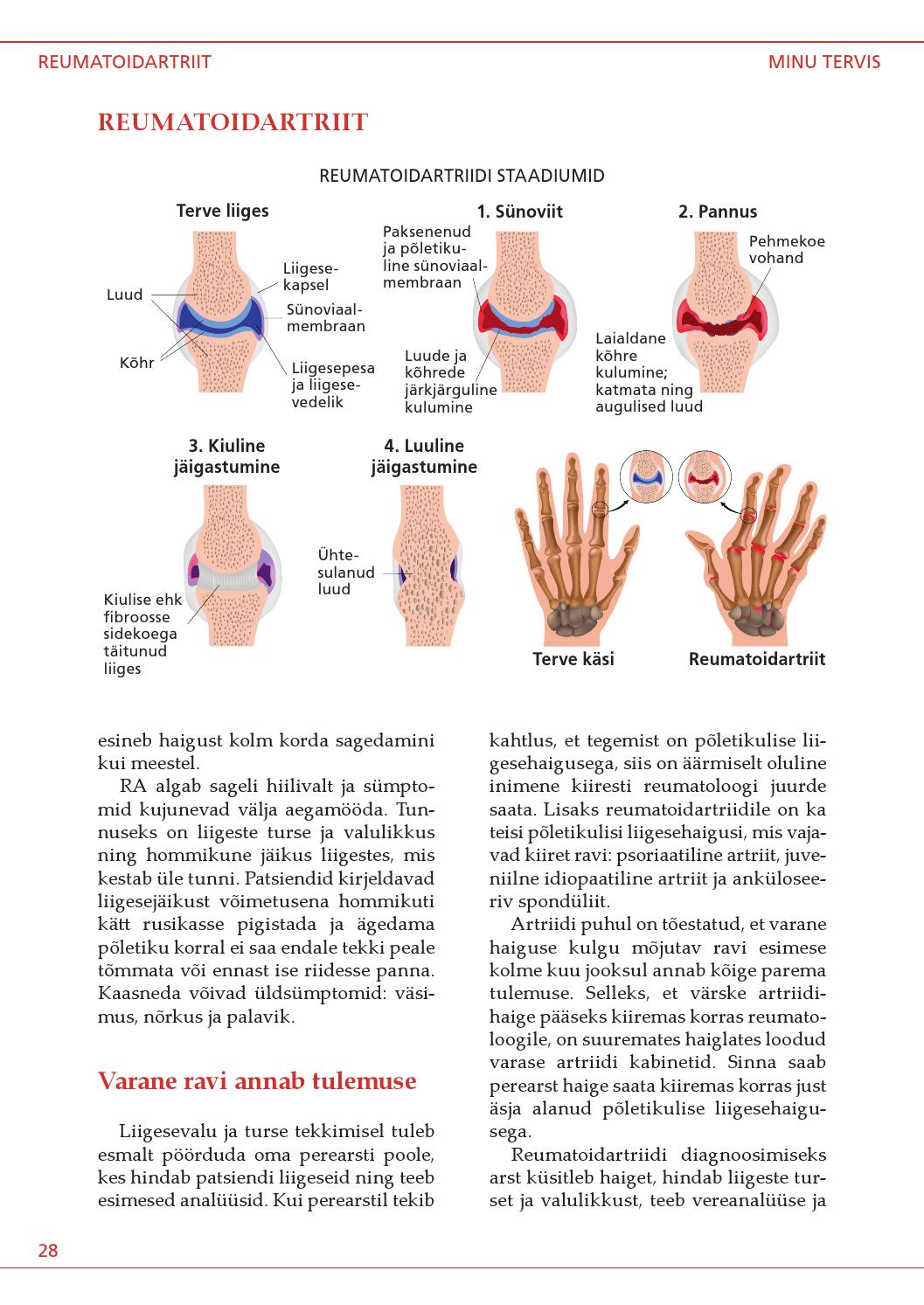 liigeste jarkjargulised haigused hurt harjade sormed
